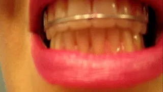 Close Up Mouth Teeth and Retainer