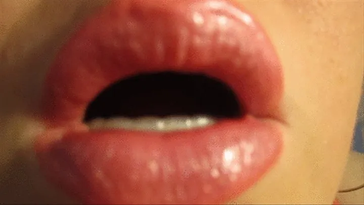 Lips, Kisses, Retainers