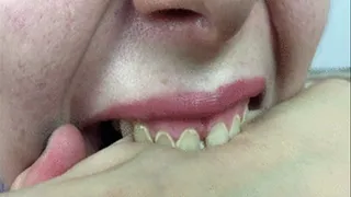 Bad Teeth of doll
