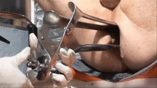 Speculum Anal Stretch