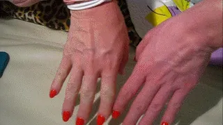 swollen veins size XXXL (hand expr)