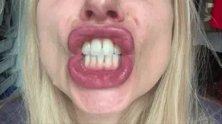 Square lips 3