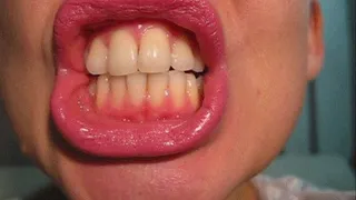 sharp teeth (close-ups)