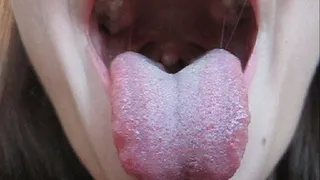 MOUTH, THE UVULA AND TONSILS (C)