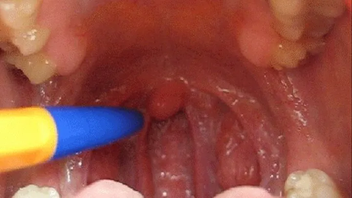 MY UVULA CLOSE UP (u)