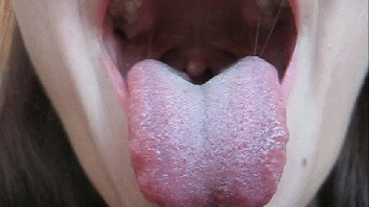 MOUTH, THE UVULA AND TONSILS (m)