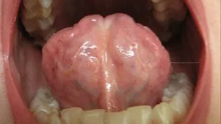 TONGUE IN THE MOUTH (m)