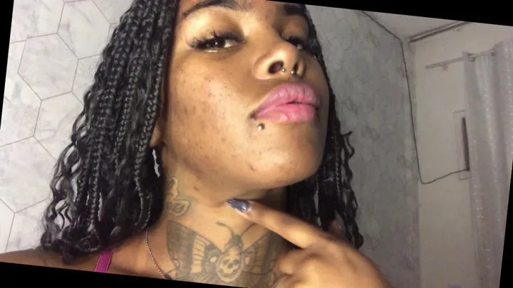 Black Girl Pimple Fetish