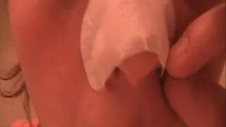 Blackhead and Pus Removal using a Biore Nose Strip * ***