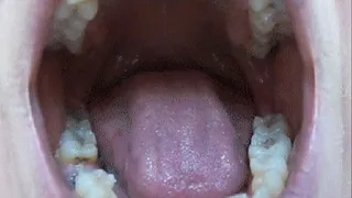 DENTIST EXPLORES MY MOUTH (ex)