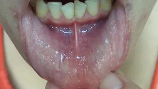 PULLING DOWN LIP