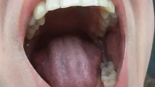 ORAL INSPECTION BEFORE AND AFTER CHEWING OF SWEETS