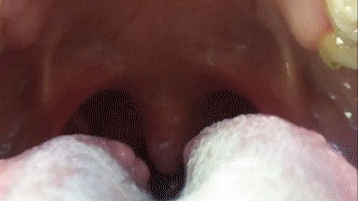 UVULA MOVEMENTS