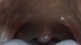 UVULA MOVEMENT