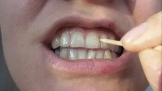 MOUTH TRAVEL