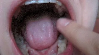 FINGER ON TEETH