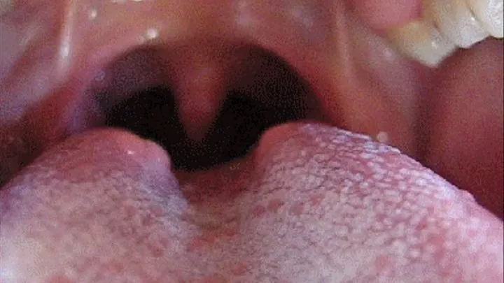 INSIDE THE MOUTH