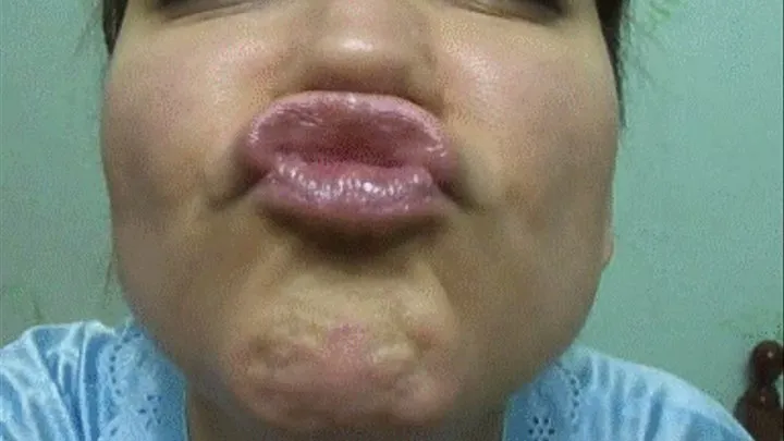 PUCKERING LIPS (l)