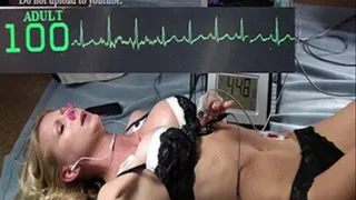 Breath holding with ECG jumbo.