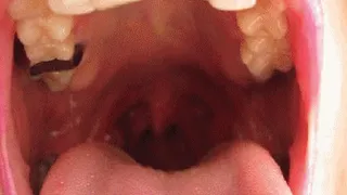 UVULA AND THROAT 7