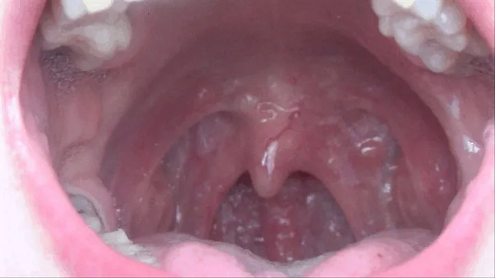 ORAL CAVIT CLOSE UP TO THE CAMERA 5