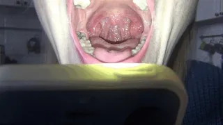To touch the tonsils and uvula (T)
