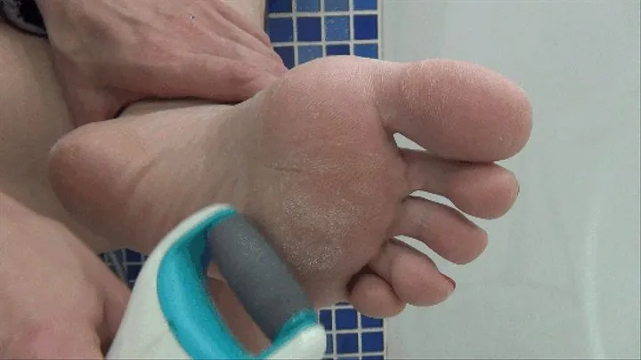 The skin on my soles is very rough (F)