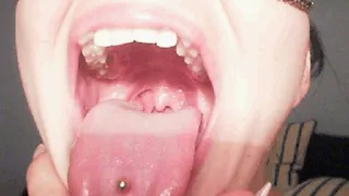 Uvula and throat 3 ( With snake of fruit jellies)