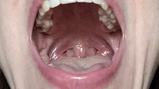 Mouth, tongue and uvula movements closeup 2 U