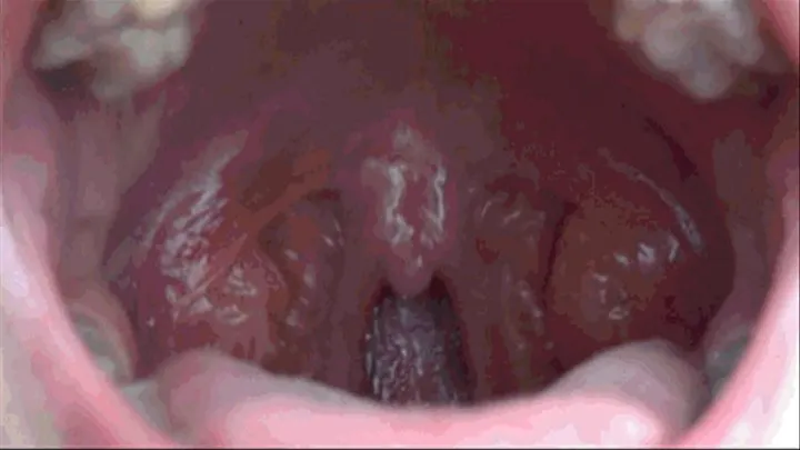 THROAT AND UVULA EXTREMELY CLOSE UP 2