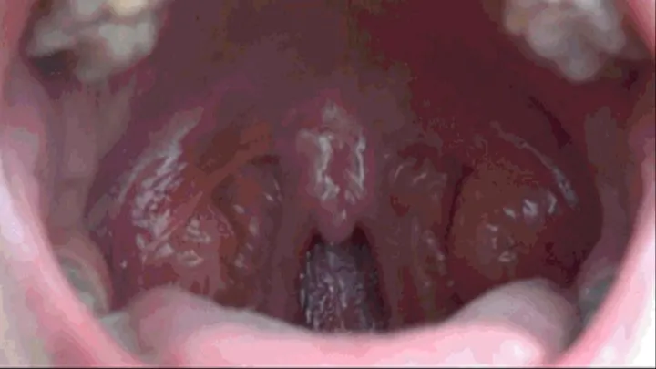 THROAT AND UVULA EXTREMELY CLOSE UP 2 (Th)