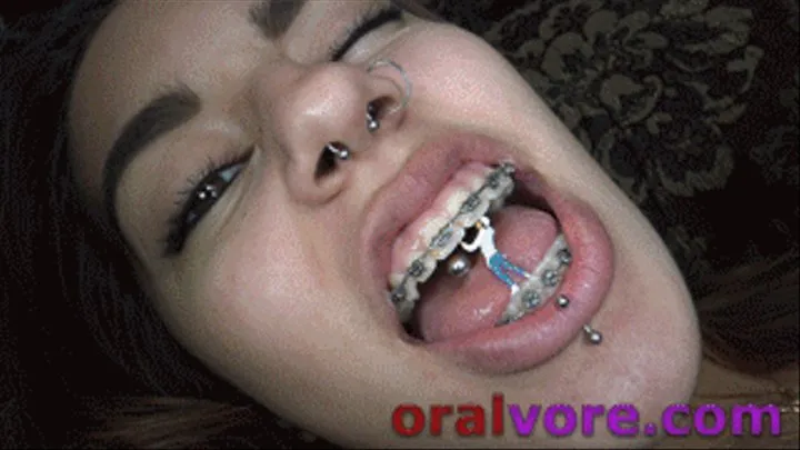 Wink Swallows Her Orthodontist