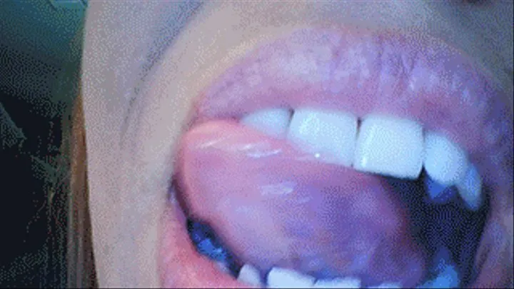 Cara's Endoscope Mouth Tease