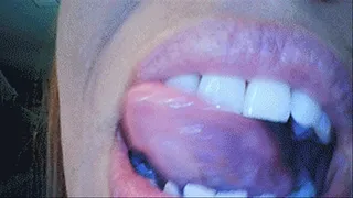 Cara's Endoscope Mouth Tease