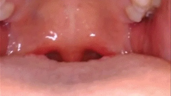 Epiglottis Endoscopic Tour