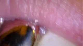 Girl's Gold Teeth Endoscope View