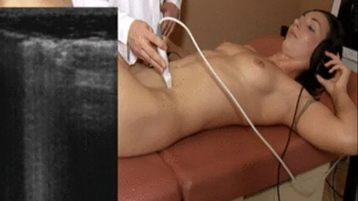 Summer ultrasound of abdomen.