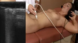 Summer ultrasound of abdomen.