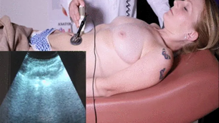 Ultrasound of Bree`s abdomen.