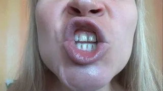 Square Lips