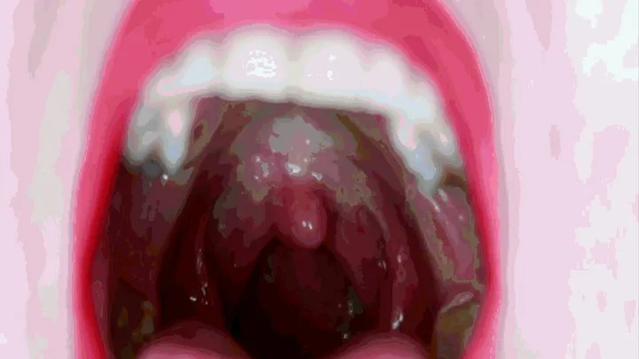 My cute uvula