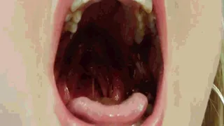 Chocolate mouth