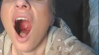 TONSILS AND THROAT