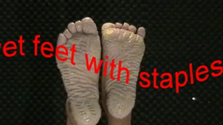 Bianca's wet feet with staples 1