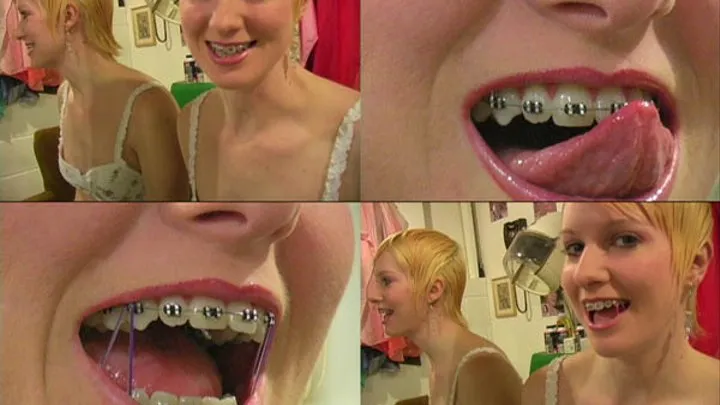 Woman with Teeth Braces and Rubber Bands part 1