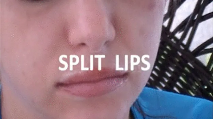 Split Lip