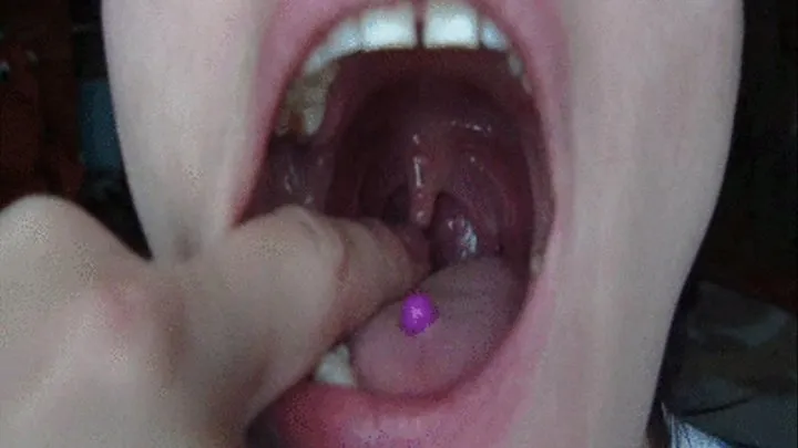 tonsils uvula m