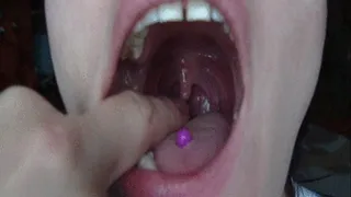 tonsils uvula m