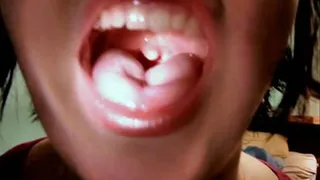 Uvula Showing REQUEST Oct 08 2010 HQ