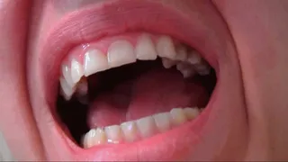 more of my teeth